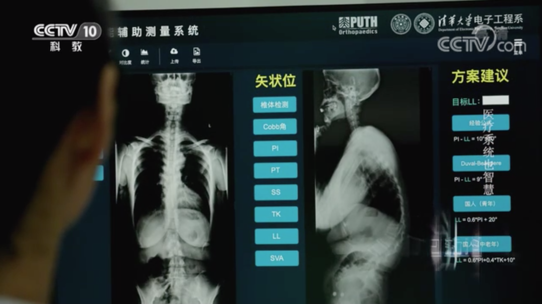 电子系团队成果被中央电视台科教频道报道